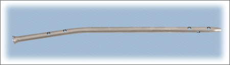 Interlock Tibia Nail