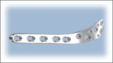 Lateral Tibia Locking Plate (Right/Left Leg)
