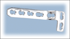 Locking L-Buttress Plate 4.5mm (Right/Left Leg)
