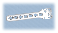 Proximal Humerus Locking Compression Plate 3.5mm